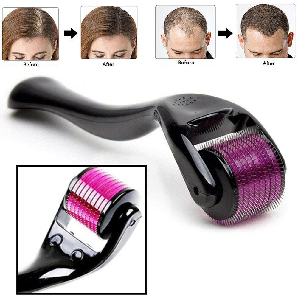 0.5mm Derma Roller – 540 Micro Needle Skin & Scalp Roller for Hair Growth, Facial Care & Skin Repair | 1 Pack