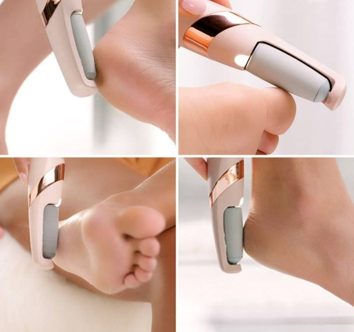 Rechargeable Electric Foot File & Callus Remover – Painless Dead Skin Remover for Soft, Smooth Feet | Areza